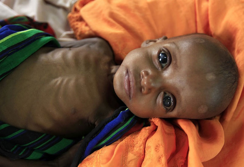 Sudanda milyonlarla insan yavaş-yavaş aclıqdan ölməkdədir